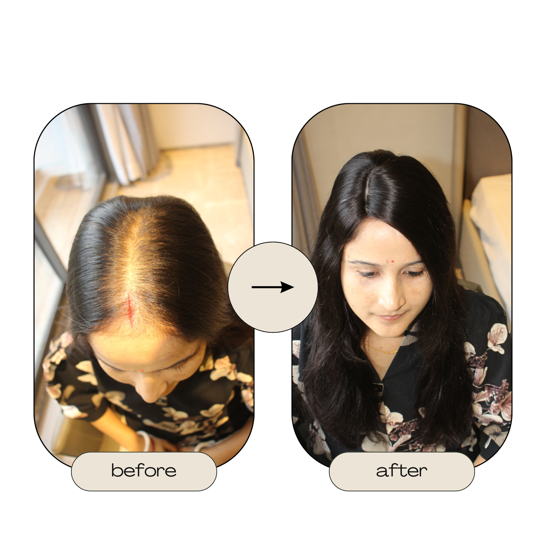 2 x 5 Silk Hair Topper | Ewa Hair